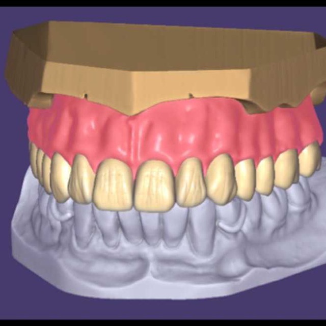 dentalsoft3d